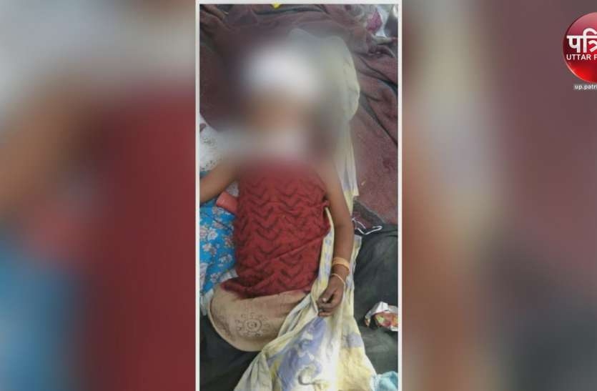 masum bachchi उसे बेेरहमी से मार दिया गया लेकिन न शहर जागा न पुलिस ने अपनी जिम्मेदारी निभाई