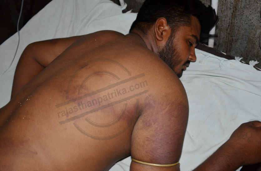 Beaten the guards detainee in prison in bhilwara जेल में प्रहरियों ने एक बंदी के साथ मिलकर आर्म्स एक्ट के बंदी को पीटा, जेलर को पता न लगे इसके लिए कर दिया टॉयलेट में बंद