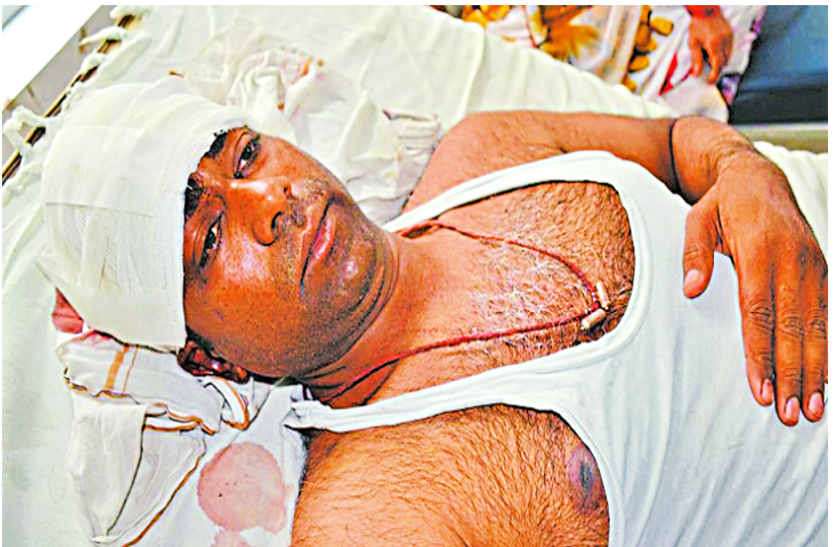 Attack on water park operative couple in bhilwara ट्यूब में बैठ रहे थे दो से अधिक, रोका तो वाटर पार्क संचालक दंपती पर हमला