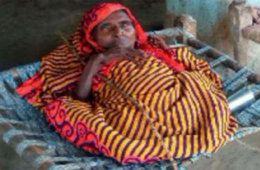 lady height सिर पर छप्पर गिरने के बाद 5 फीट से 2 फीट की रह गयी महिला, डॉक्टर्स भी हैरान