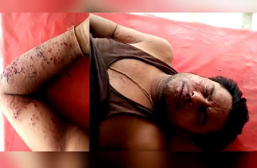 mobile phone burst in mobile shop in shrimadhopur sikar बड़ी खबर: तेज धमाके के साथ मोबाइल की बैटरी में विस्फोट, उड़े परखच्चे