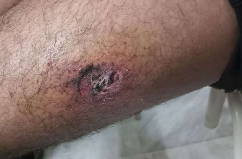 After the mutual talk, the youth of Kota shot the Kangar colony आपसी कहासुनी के बाद कंजर कॉलोनी में कोटा के युवक को गोली मारी