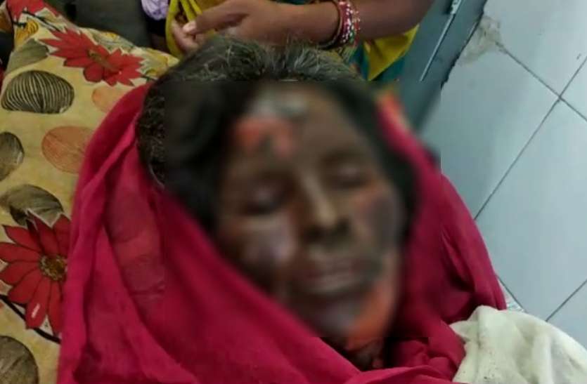 Burnt Alive शराब के लिए नहीं दिए रुपए तो मिट्टी का तेल छिड़क कर पत्नी को किया आग के हवाले