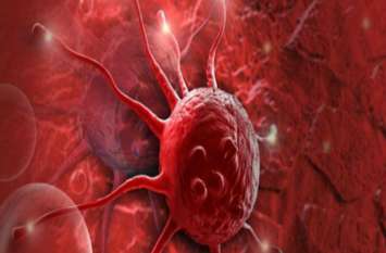 Treatment of cancer Treatment of cancer