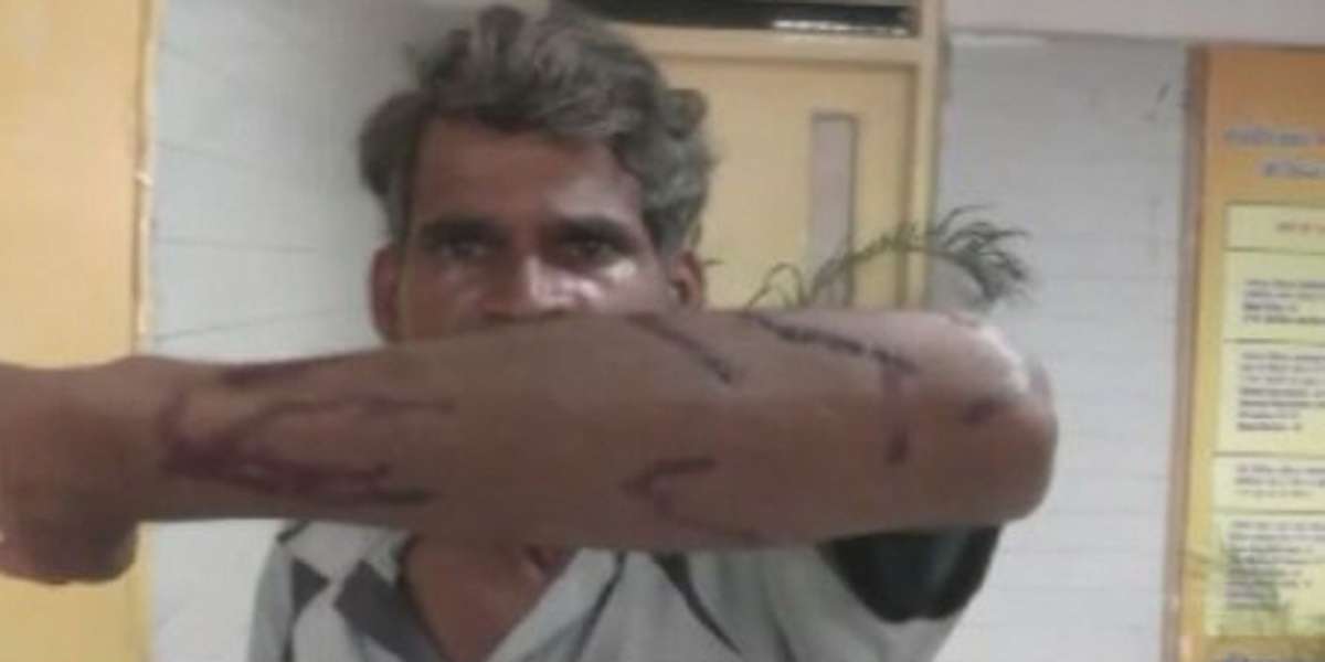 Husband throws stones at wife's head