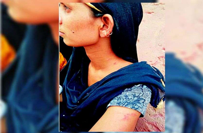 woman एक छोटी सी बात को लेकर ससुराल पक्ष ने इस महिला के साथ की ये घिनौनी हरकत