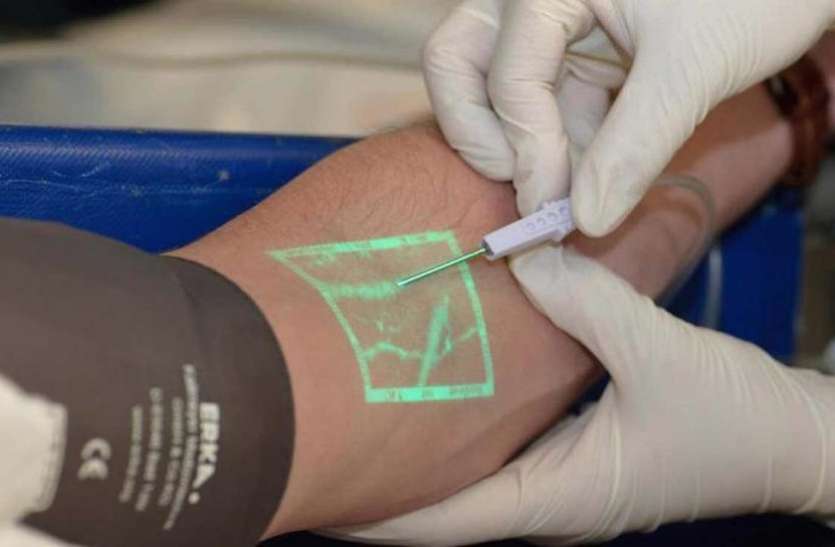 Vein Viewer Flex World Blood Doner Day: त्वचा पर रौशनी पड़ते ही दिखने लगती हैं नसें, ब्लड डोनेशन के लिए वरदान है ये डिवाइस
