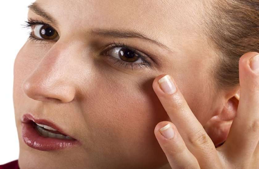 dark circles of eyes dark circles of eyes