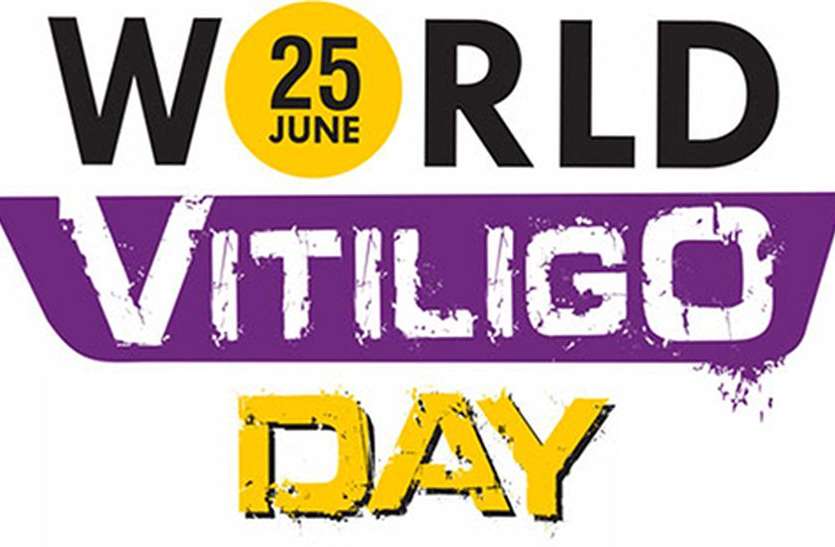 World Vitiligo Day नहीं है ये छूत की बीमारी , सिर्फ दाग ही तो है उपचार से है इस बीमारी का इलाज़ संभव