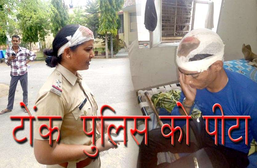 Killer attack on policeman विवाहिता को दस्तायाब करने गई पुलिस पर किया जानलेवा हमला, महिला उपनिरीक्षक सहित कांस्टेबल घायल