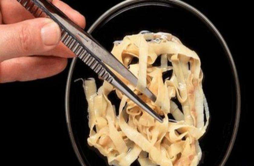 tapeworm eggs