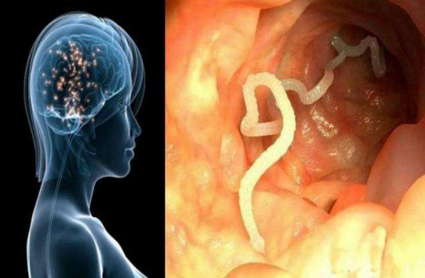 tapeworm eggs