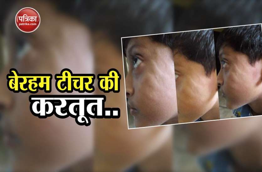 crime बैग पैक करने पर स्कूल टीचर को आया गुस्सा, दूसरी कक्षा के छात्र को बेरहमी से पीटा