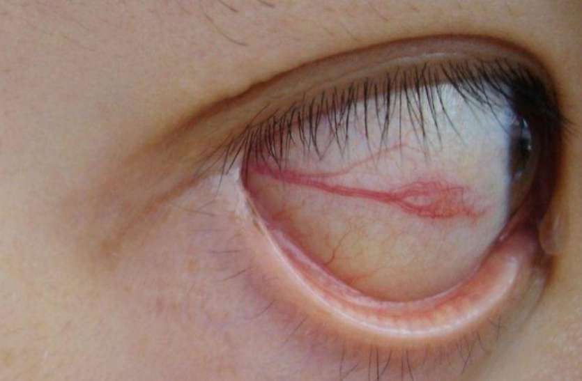 Eyeliner पाकिस्तान के बने आईलाइनर को लगाने से ऑस्ट्रेलिया के 3 बच्चे बीमार