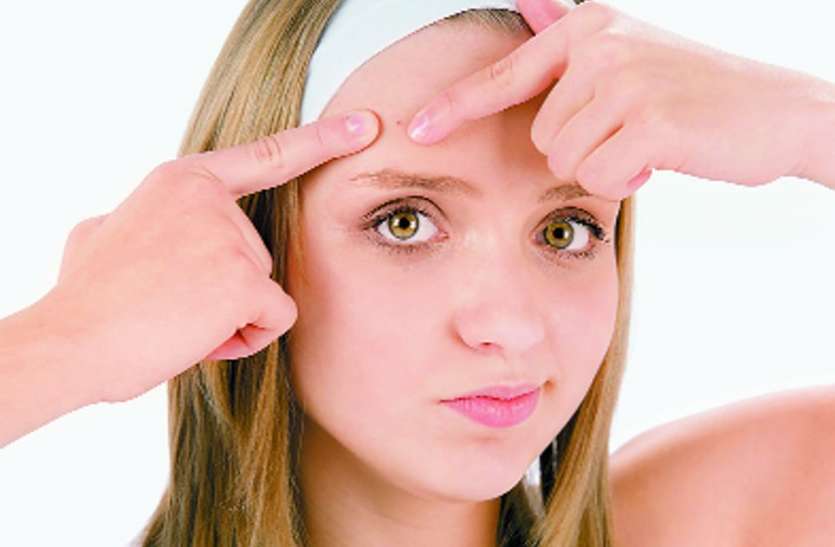 pimples पावर ऑफ हाइड्रोजन से तो नहीं मुंहासे?