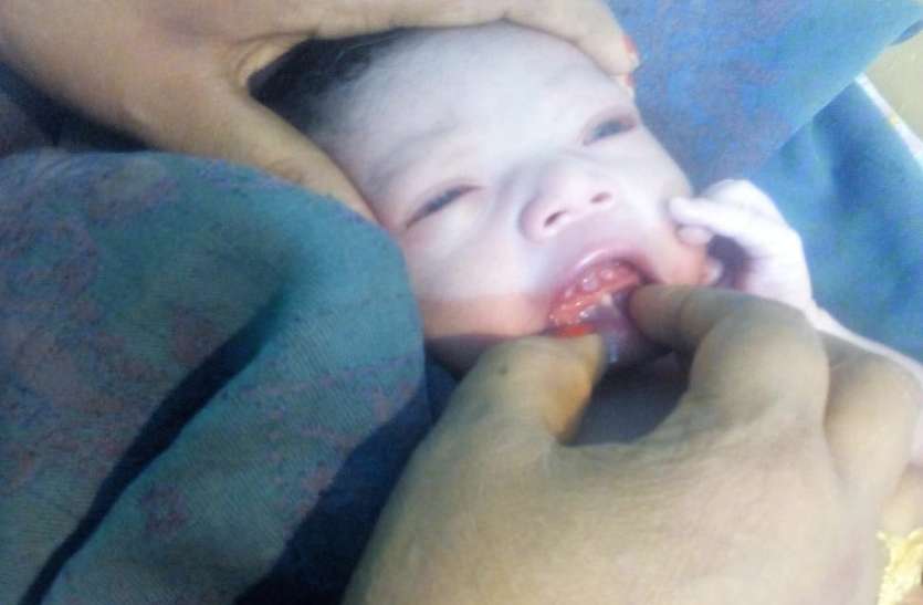 5 teeth baby कुदरत का ये करिश्मा देख डॉक्टर भी रह गए हैरान, जन्म लेते ही बच्चे के मुंह में दिखे 5 दांत