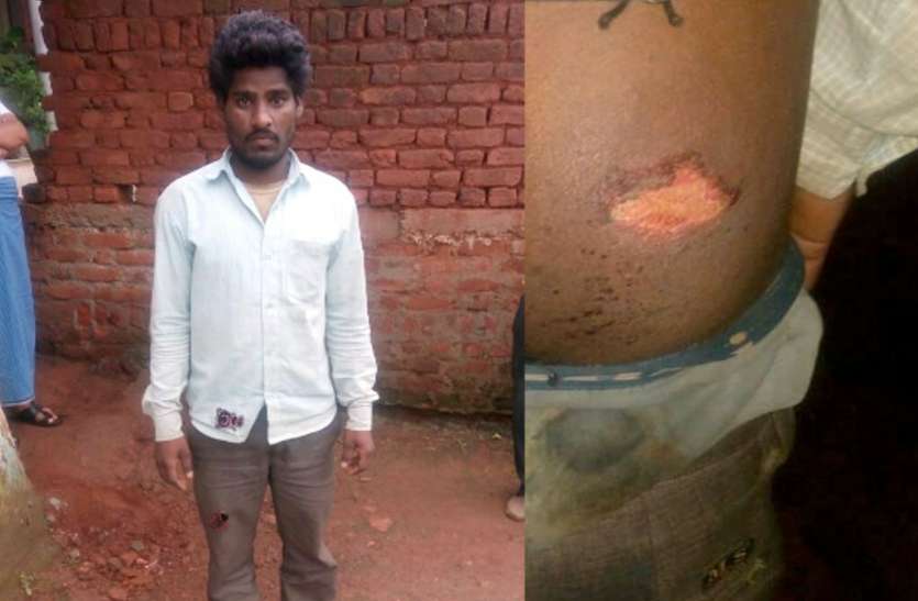 MP Police brutally beaten a boy inside police station बेरहम पुलिस- इतनी सी बात पर पुलिस ने युवक की चमड़ी उधेड़ दी