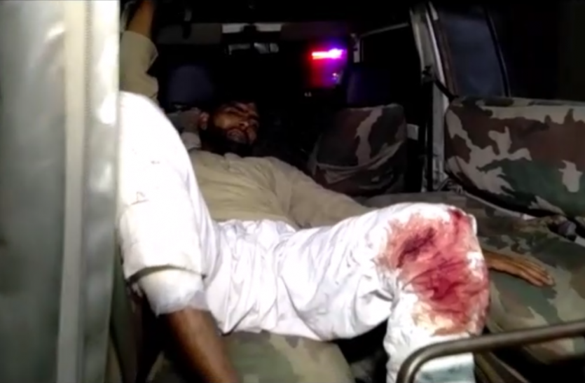 encounter in Greater noida ग्रेटर नोएडा में फिर एनकाउंटर, एक बदमाश के पांव में लगी गोली, दूसरा फरार