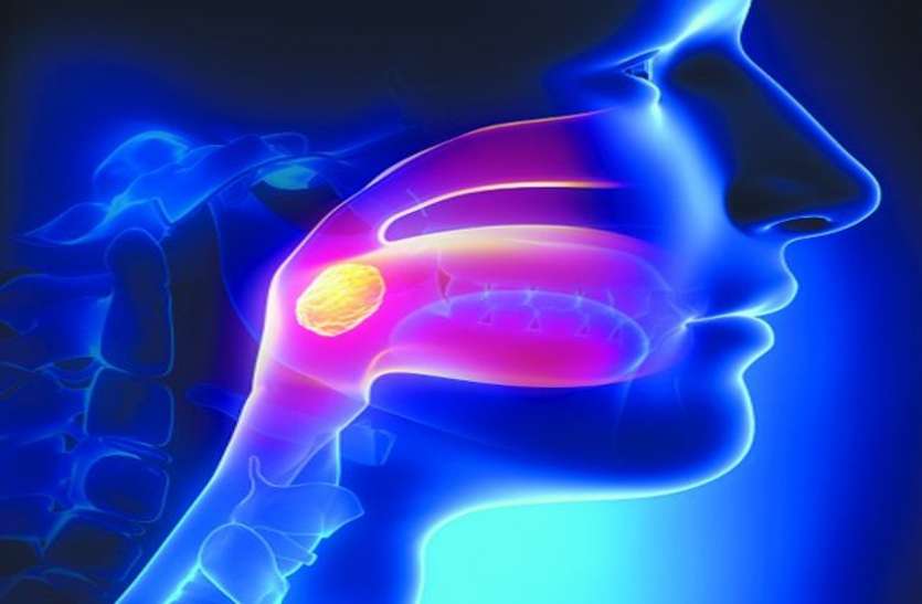 Kidney Awareness Week लार नली में भी बन सकती है पथरी