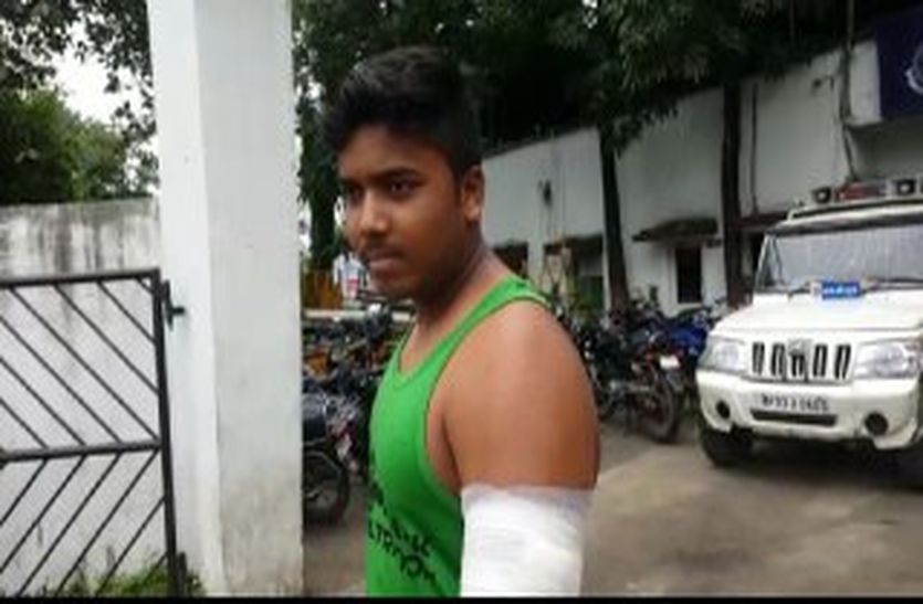 crime news चोरी करते पकड़ाए बदमाश ने रहवासियों पर चाकू से किया हमला, भागते हुआ बोला फिर आऊंगा तब जान से मार दूंगा
