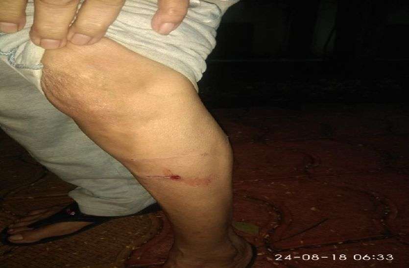 crime मार्निंग वॉक करने वाले बन रहे कुत्तों का निशाना, 40 लोगों को काटा