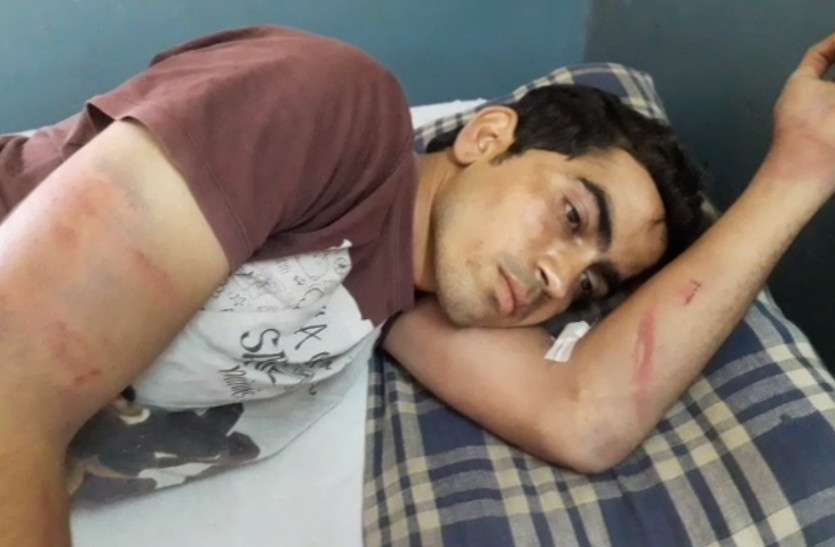 man beaten by members of family on land dispute in Pushkar अपने ही बन बैठे बैरी, जमीनी विवाद को लेकर युवक के परिजनों ने ही किया थर्ड डिग्री टॉर्चर, अधमरा कर धोरों में पटका