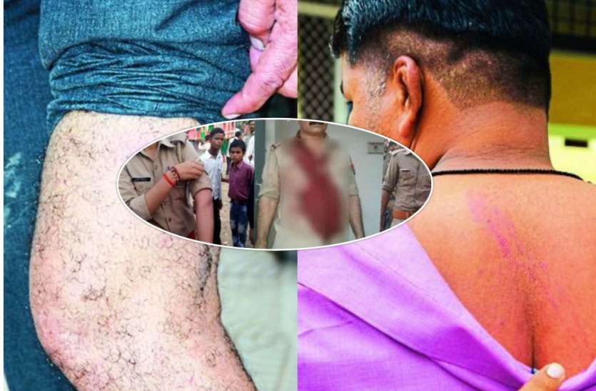 villagers beaten to police constables चोरी के आरोपित को पकडऩे गये पुलिसकर्मियों का किया बुरा हाल, एक घंटे तक बंधक बनाकर की मारपीट