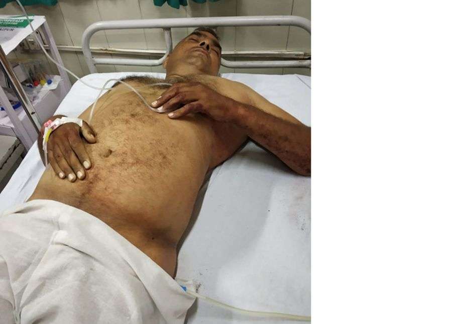 firing on Police, constable injured