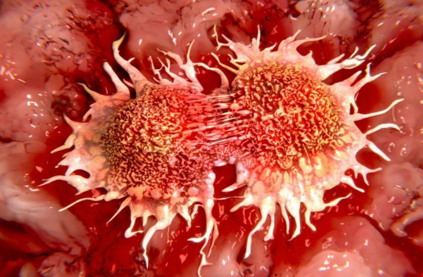 health खतरनाक कैंसर की बीमारी कर रही है आपकी ये जॉब , ध्यान रखें ये बातें