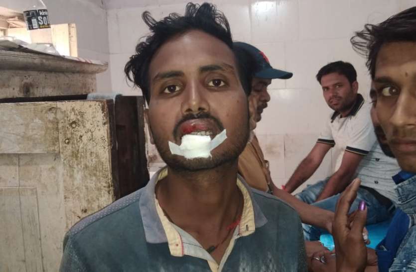 Accidant सवारी बस और डंपर की टक्कर में 10 से 15 यात्री हुए घायल