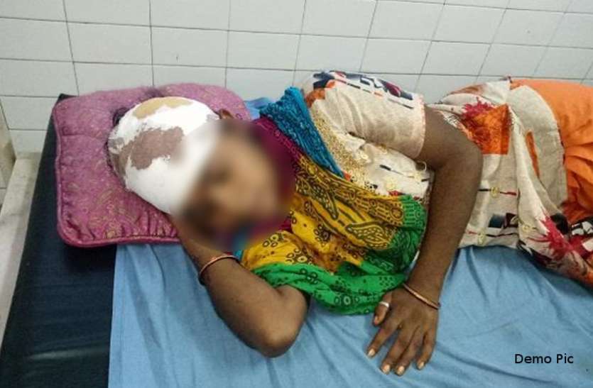 banswara बांसवाड़ा : देर रात नशे में आया युवक और ईंट से फोड़ दिया महिला का सिर, पूरा मामला जानकर चौंक जाएंगे आप