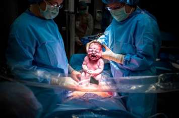 birth birth