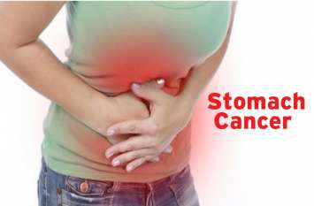 Stomach Cancer Stomach Cancer