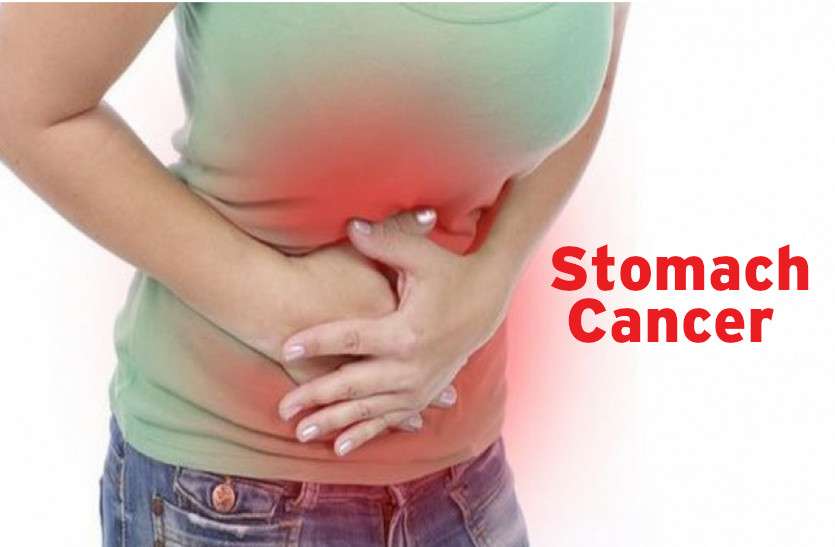 Stomach Cancer Symptoms Treatment à¤¬ à¤¹à¤¦ à¤˜ à¤¤à¤• à¤¹ à¤¤ à¤¹ à¤ª à¤Ÿ à¤• à¤• à¤¸à¤° à¤œ à¤¨ à¤‡à¤¸à¤• à¤²à¤• à¤·à¤£ à¤