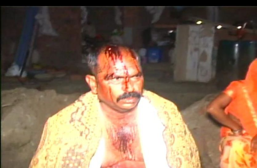 crime news टाउनशिप सुपरवाइजर के घर हथियारबंद बदमाशों ने डाली डकैती, चाकू दिखा कर सिर पर मारे डंडे