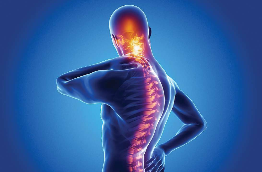 spondylitis-diseases-and-its-cure आप भी स्पॉन्डिलाइटिस से हैं परेशान, तो जानें ये 5 खास बातें