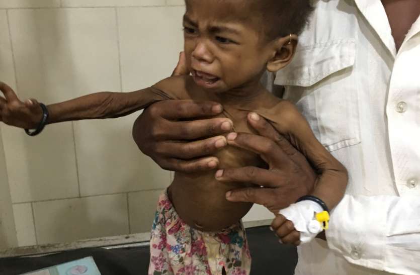 Was admitted twice innocent, finally succumbed दो बार भर्ती हुआ था मासूम, आखिर तोड़ा दम