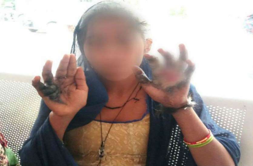 Saas scorched bahu तांत्रिक के कहने पर सास ने बहू के साथ किया कुछ ऐसा, कि करवाचौथ से पहले ही...