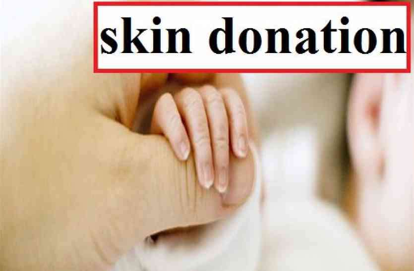 skin donation 85 लोगों ने किया त्वचा दान, 1500 लोगों ने ली शपथ