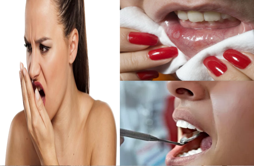 this-home-remedies-beneficial-for-mouth-odor-ulcers-and-teeth मुंह की दुर्गंध, छालों और दांतों की समस्या के लिए जानें ये घरेलू नुस्खे