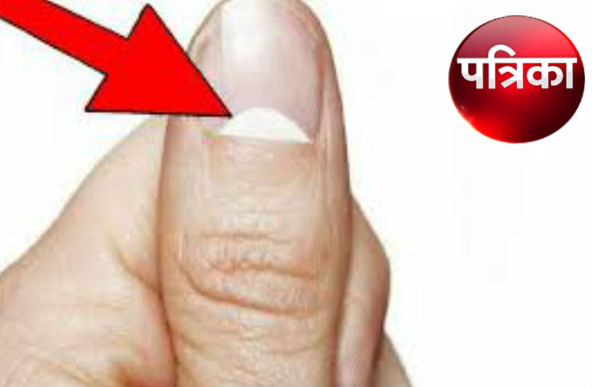 know meaning of white half moon mark on nails according to astrology | अगर इन उंगलियों के नाखूनों पर है ये अर्धचंद्र का निशान तो समझिए किस्मत चमकने वाली है... | Patrika News know meaning of white half moon mark on nails according to astrology | अगर इन उंगलियों के नाखूनों पर है ये अर्धचंद्र का निशान तो समझिए किस्मत चमकने वाली है... | Patrika News