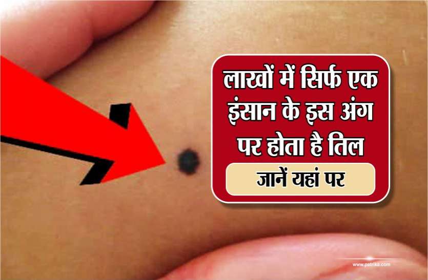 Lucky Moles On Male And Female Body à¤² à¤– à¤® à¤¸ à¤° à¤« à¤à¤• à¤‡ à¤¸ à¤¨ à¤• à¤‡à¤¸ à¤… à¤— à¤ªà¤° à¤¹ à¤¤ à¤¹ à¤¤ à¤² à¤œ à¤¨ à¤¯à¤¹ à¤ªà¤° Patrika News lucky moles on male and female body