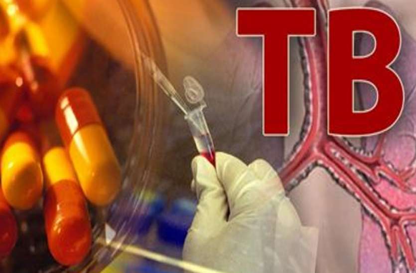 bedaquiline drug for tuberculosis tb diagnosis and treatment टीबी के मरीजों के लिए लॉन्च हुई ये नई दवा, सरकारी अस्पतालों में मिलेगी मुफ्त