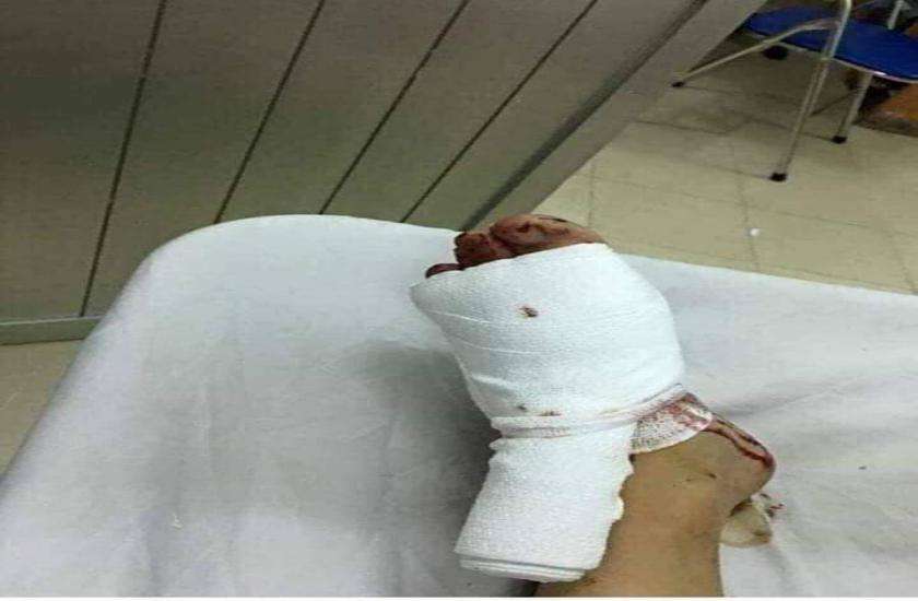 husband beats his wife