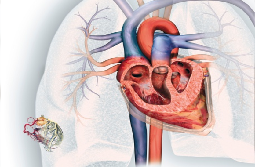 heart-s-protective-armor-is-pericardium दिल का सुरक्षा कवच पेरिकार्डियम, जानें इसके बारे में