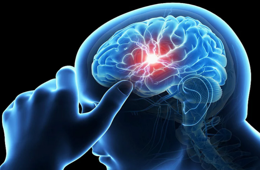 brain stroke B Alert - ब्रेन स्ट्रोक में मरीज को एक करवट से लेटाएं, दवा पानी ना दें