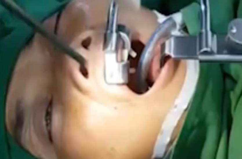 shocking video सर्जरी के दौरान महिला के गले से निकली ऐसी भयानक चीज, देखकर कांप जाएगी रुह