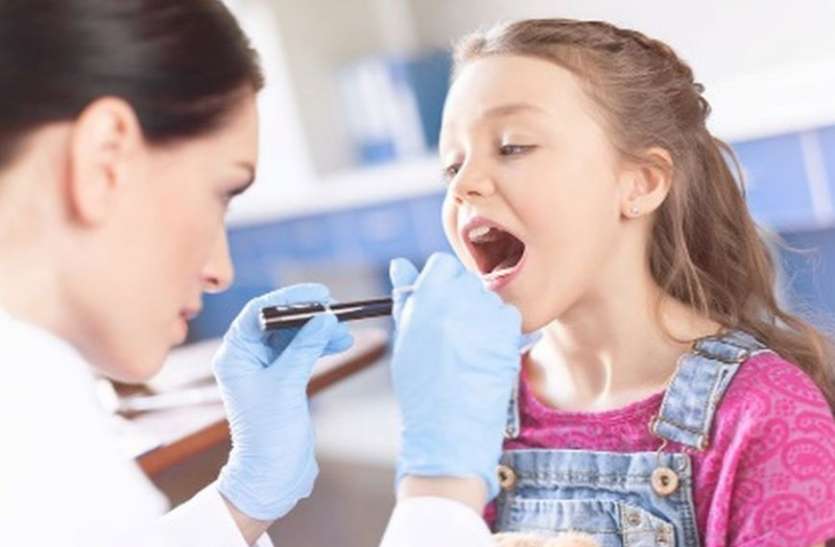 tonsillitis बच्चों में क्यों बार—बार होता है टॉन्सिलाइटिस