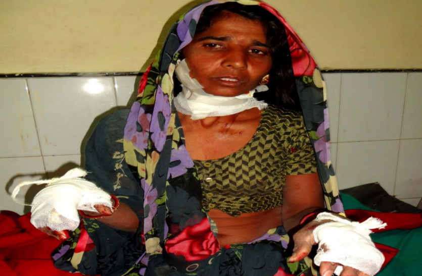 Lady's jewelry looted in bhilwara रास्ता पूछने के बहाने चाकू से हमला, महिला के जेवर लूटे