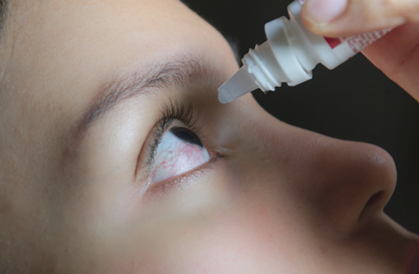 dry eye syndrome इन खास टिप्स काे अपनाकर ड्राई आई सिंड्रोम से बच सकते हैं आप